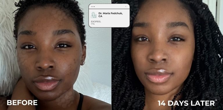 Before and after — regenerative protocol clinical example 19