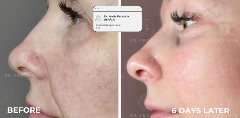 Before and after — regenerative protocol clinical example 16