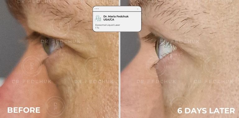 Before and after — regenerative protocol clinical example 18