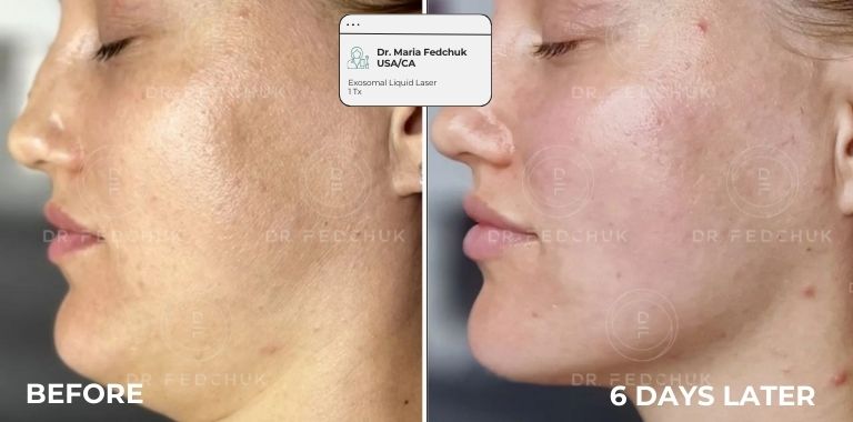 Before and after — regenerative protocol clinical example 11