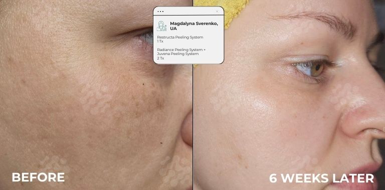 Before and after — 6 WEEKS LATER